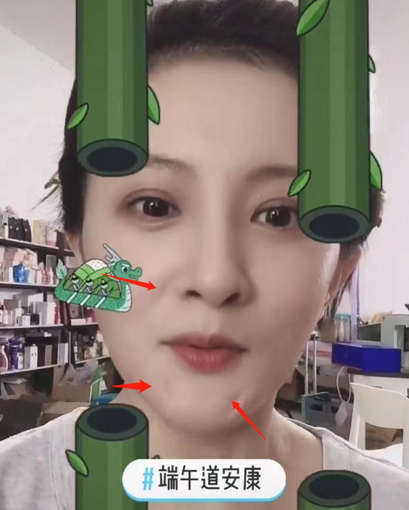 那些人下巴有坑