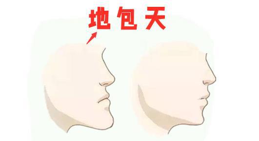 无下巴的男人命运如何