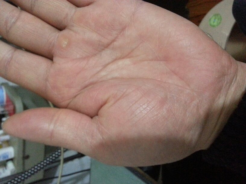 手掌上的三条横纹