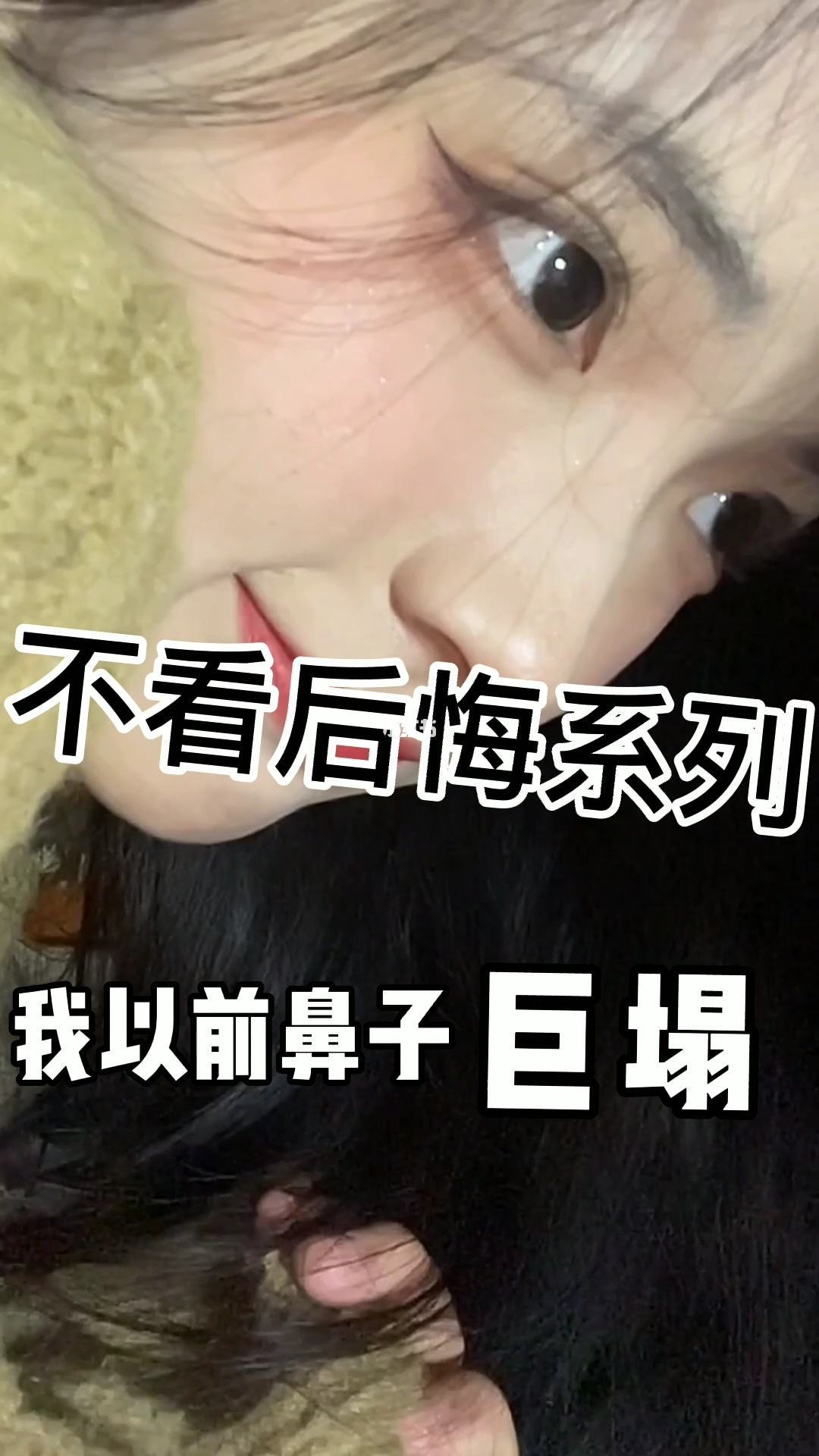 低鼻梁和高鼻梁的区别