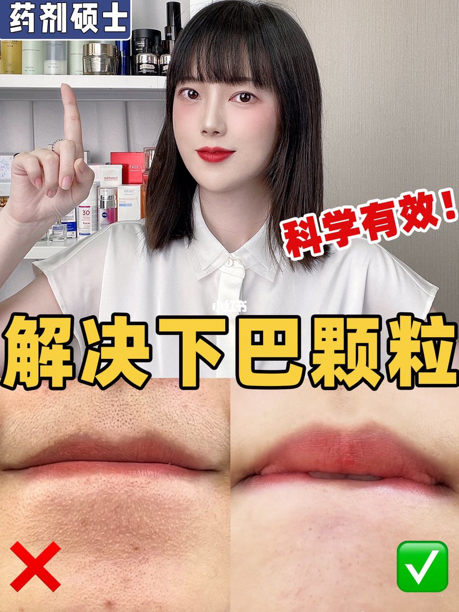 下巴突然长了一根毛